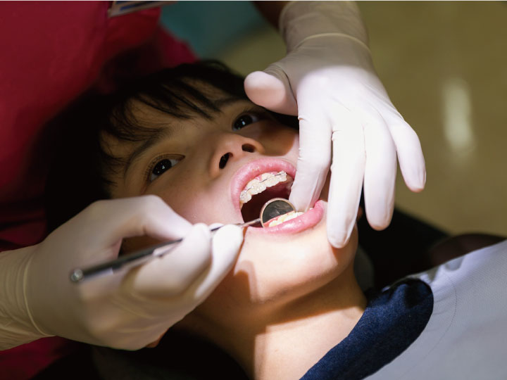 予防歯科への取組み